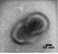 優選：Tumor-derived exosomes